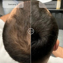 CapilRoot Pro - Recupera tu Cabello y tu Confianza en casa, Sin químicos ni pastillas + 3 Accessorios🎁+ E-book cuidados diarios del Cabello🎁+ Regalo Sorpresa🎁+ Envío GRATIS🎁